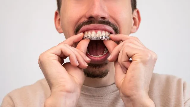 Invisalign Treatment